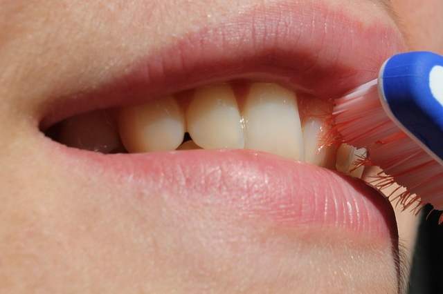 Consejos para cuidar tus dientes despus de un blanqueamiento